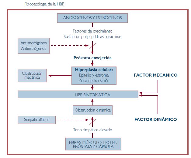 sospecha de adenoma de próstata
